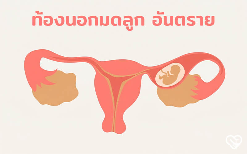 อัลตราซาวนด์