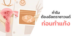 อัลตราซาวนด์